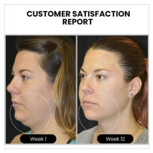 Atheniz MagneTech Acupuncture Earrings(Limited time discount 🔥 last day) - Emporium Shop