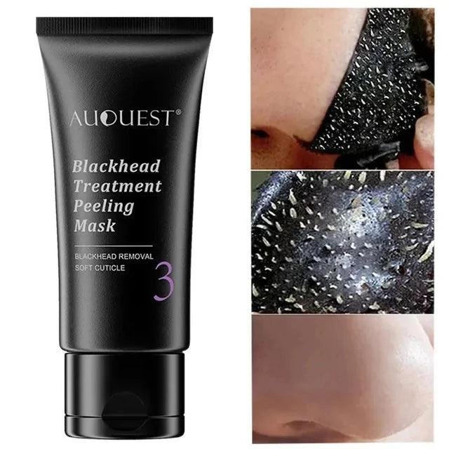 Blackhead Remover Mask - SUPER SALE π₯60% OFF - Emporium Shop