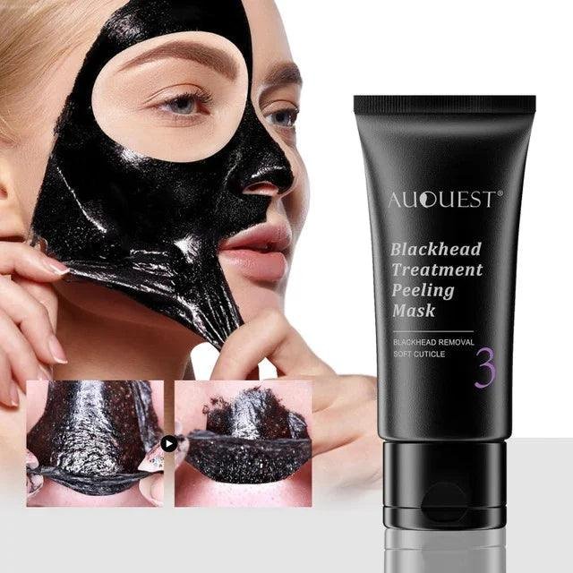 Blackhead Remover Mask - SUPER SALE π₯60% OFF - Emporium Shop
