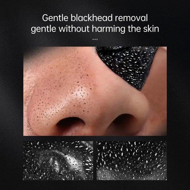 Blackhead Remover Mask - SUPER SALE π₯60% OFF - Emporium Shop