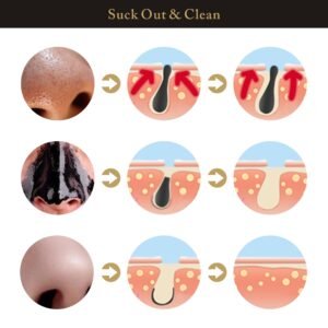 Blackhead Remover Mask - SUPER SALE π₯60% OFF - Emporium Shop
