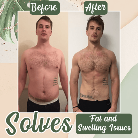 Perfect Detox Slimming Patch(Limited Time Discount π₯ Last Day) - Emporium Shop