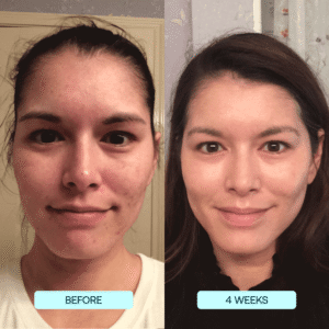 SkynPure™ - Pure Collagen Films - Emporium Shop