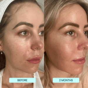 SkynPure™ - Pure Collagen Films - Emporium Shop