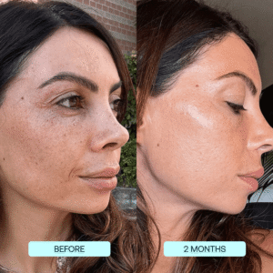 SkynPure™ - Pure Collagen Films - Emporium Shop